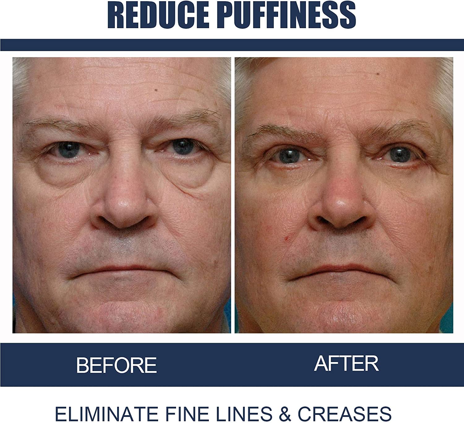Lamvpiny Himse Awaken Peptide Depuffing Eye Gel, OPENEYES Peptide Depuffing Eye Gel, Lifts Firming Anti-Wrinkle Eye Tightener, Men's Moisturizing Eye Cream, Reduces Dark Circles, Under Eye Bags - Image 4