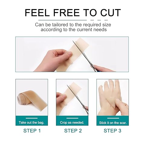 Silicone Scar Sheets (1.6” x 120” Roll-3M), Silicone Scar Tape Roll, Scar Silicone Strips, Reusable, Professional Scar Removal Sheets for C-Section, Surgery, Burn, Keloid, Acne et - Image 2
