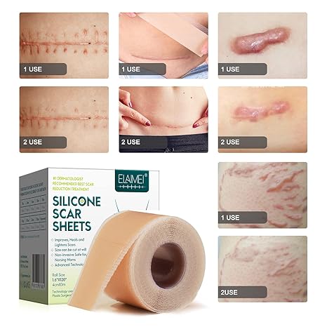 Silicone Scar Sheets (1.6” x 120” Roll-3M), Silicone Scar Tape Roll, Scar Silicone Strips, Reusable, Professional Scar Removal Sheets for C-Section, Surgery, Burn, Keloid, Acne et - Image 4