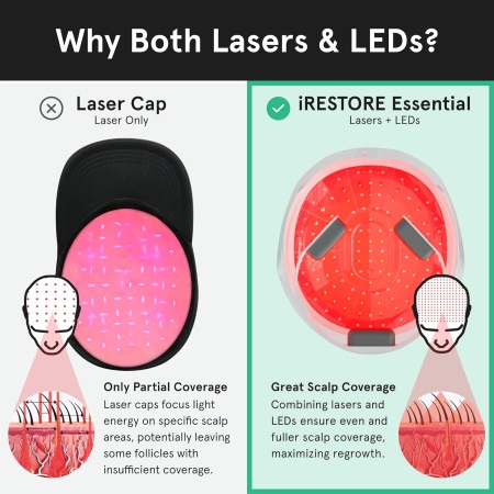 iRestore Laser Hair Growth Device