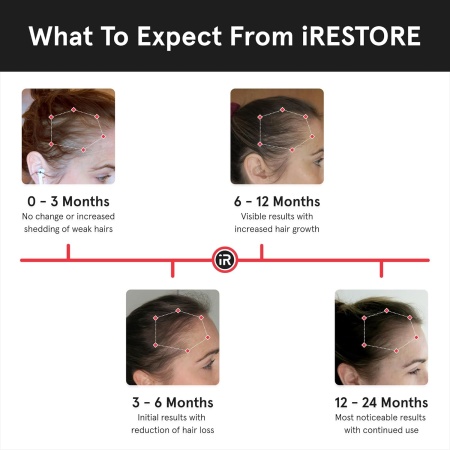 iRestore Laser Hair Growth Device