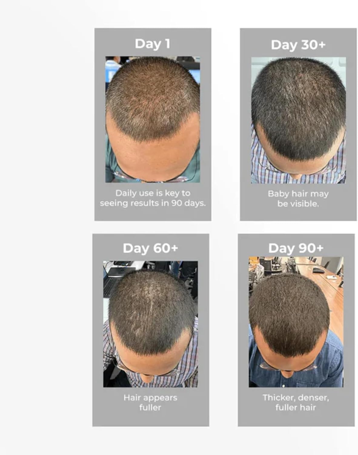 Pilgrim Hair Growth Serum | Redensyl & Anagain | Stops Hair Loss - Image 9