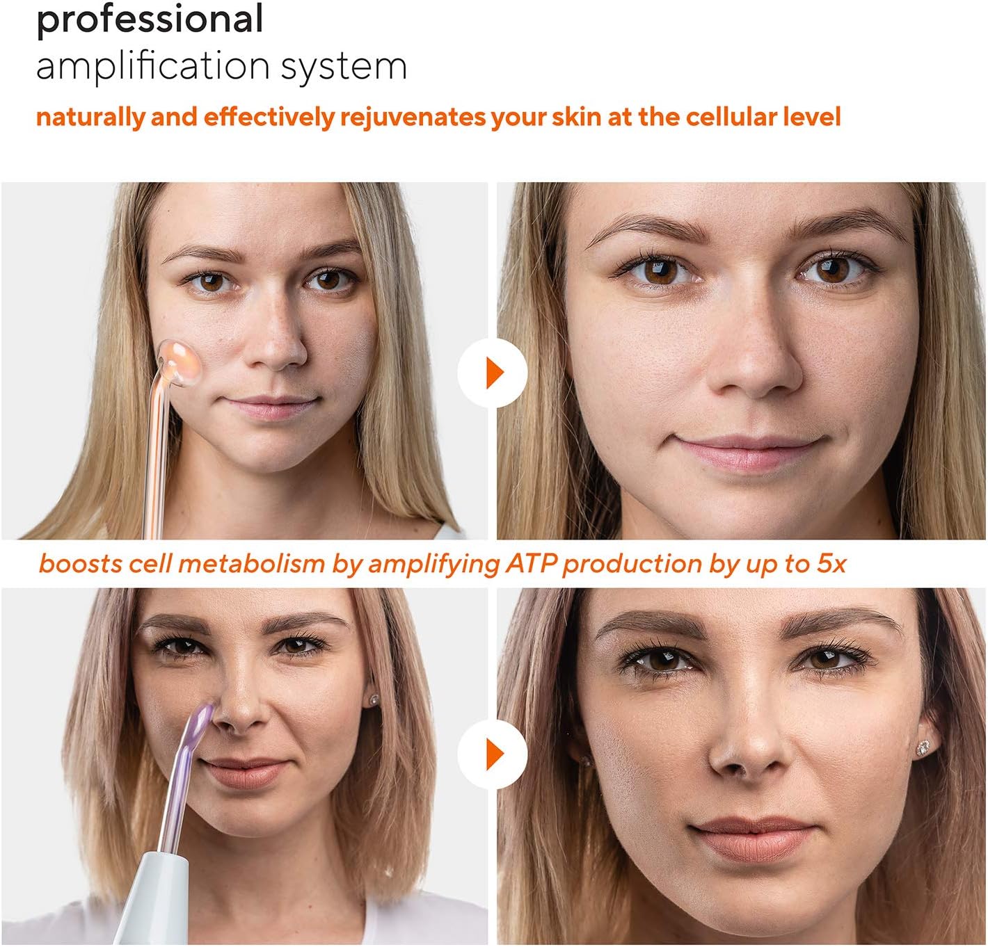 NuDerma Professional Skin Therapy Wand | High Frequency Facial - Image 5