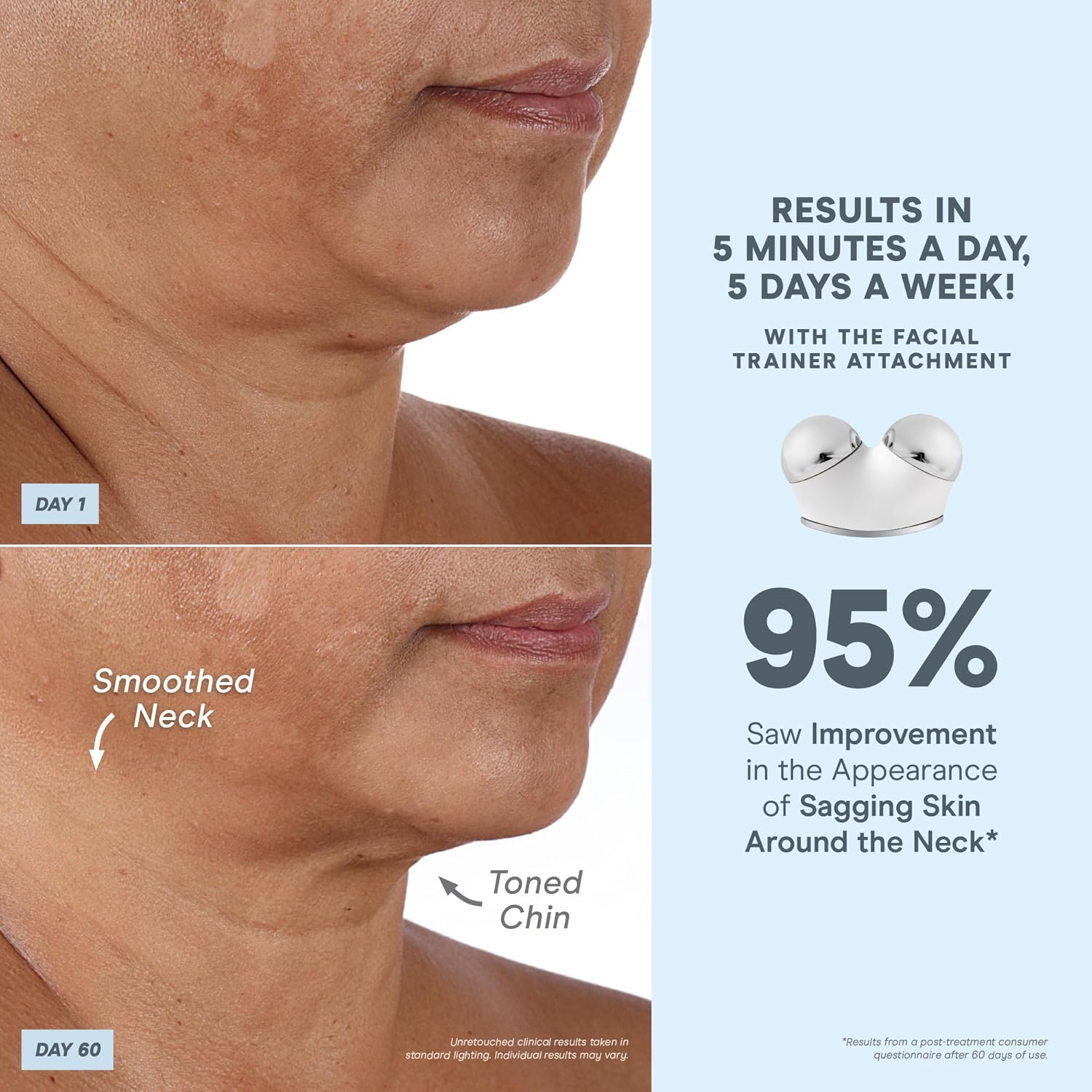 NuFACE Trinity+ Effective Lip & Eye Attachment for Microcurrent Facial Device - FDA Cleared at Home Eye Lift & Smile Lines Treatment to Tighten & Tone Hard-to-Reach Areas Around Mouth and Eyes - Image 4