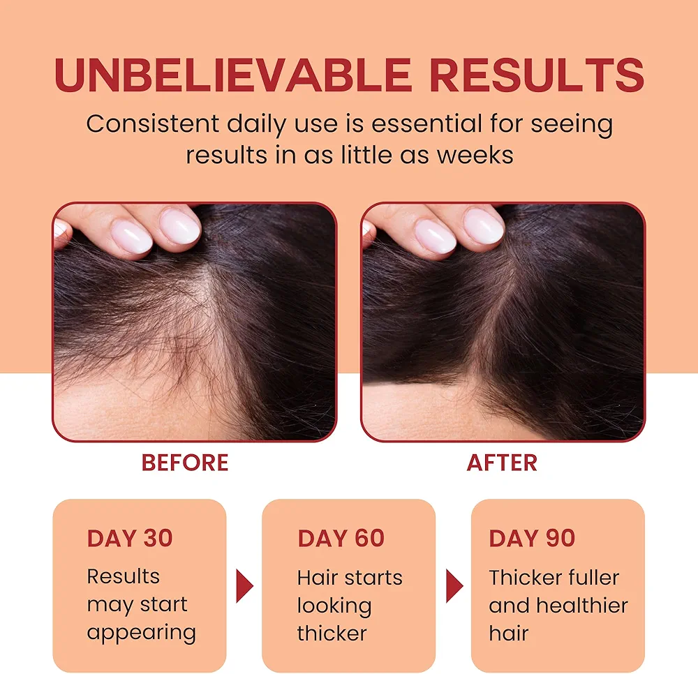 100% Pure Raw Batana Oil | For Thicker, Stronger-Looking Hair | 120 ml - Image 4