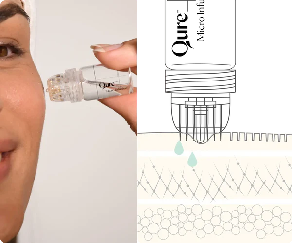 Qure Micro-Infusion System | At-Home Microneedling Device - Image 2