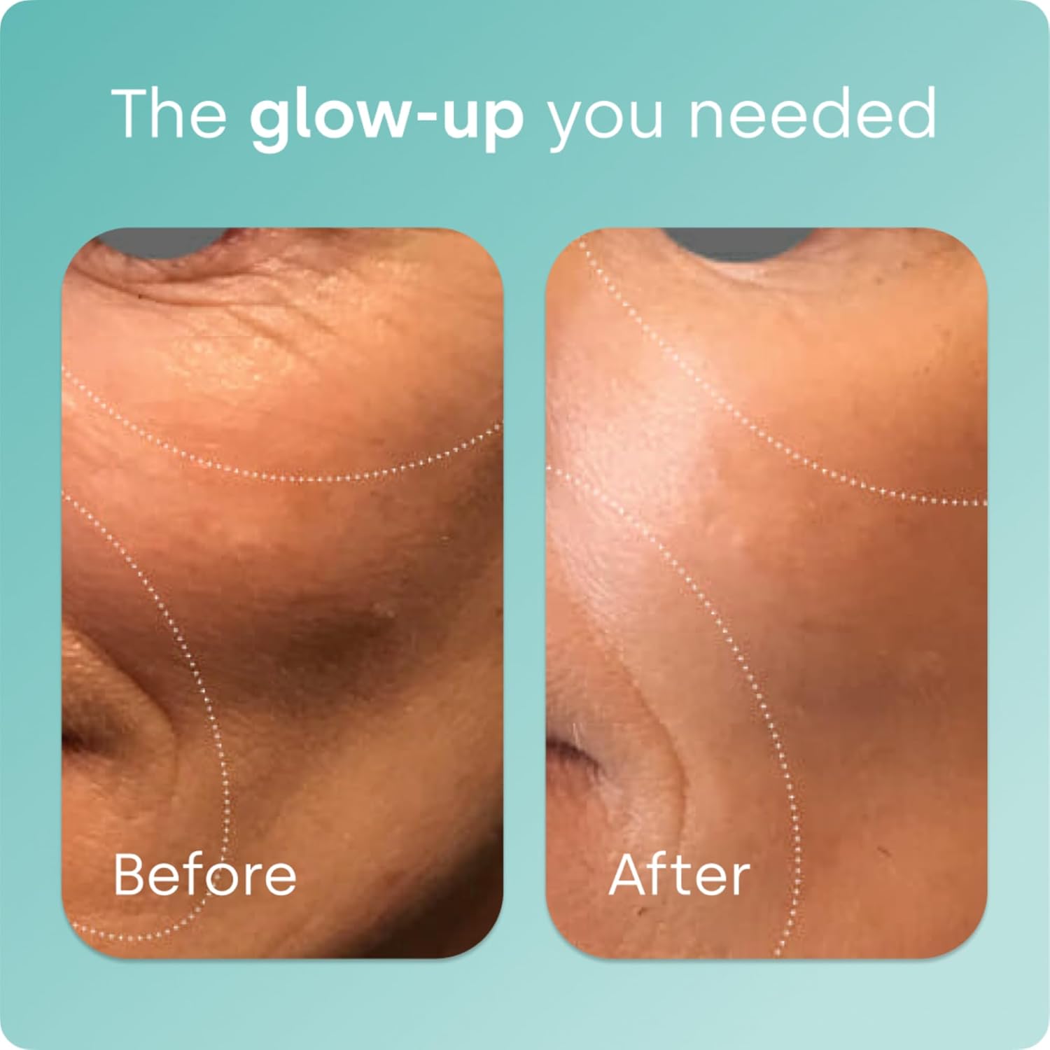 Biosil Collagen Generator with ch-OSA | Stimulates Natural Collagen Production |120 Liquid Capsules - Image 7