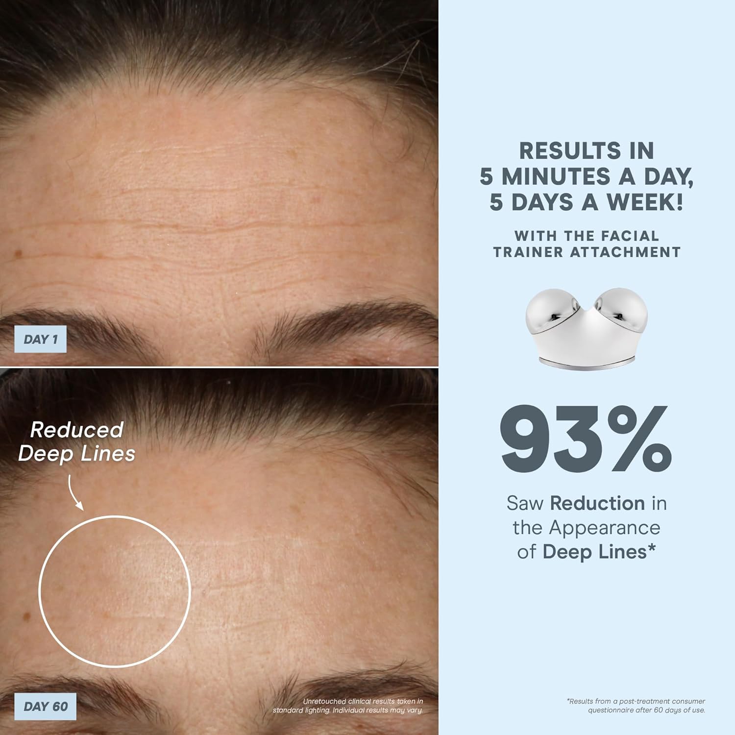 NuFACE Trinity+ Microcurrent Facial Device Kit - FDA Cleared Face Sculpting & Neck Tightening Device to Contour Cheeks & Brows + Microcurrent Gel Activator & Silk Creme - Image 2