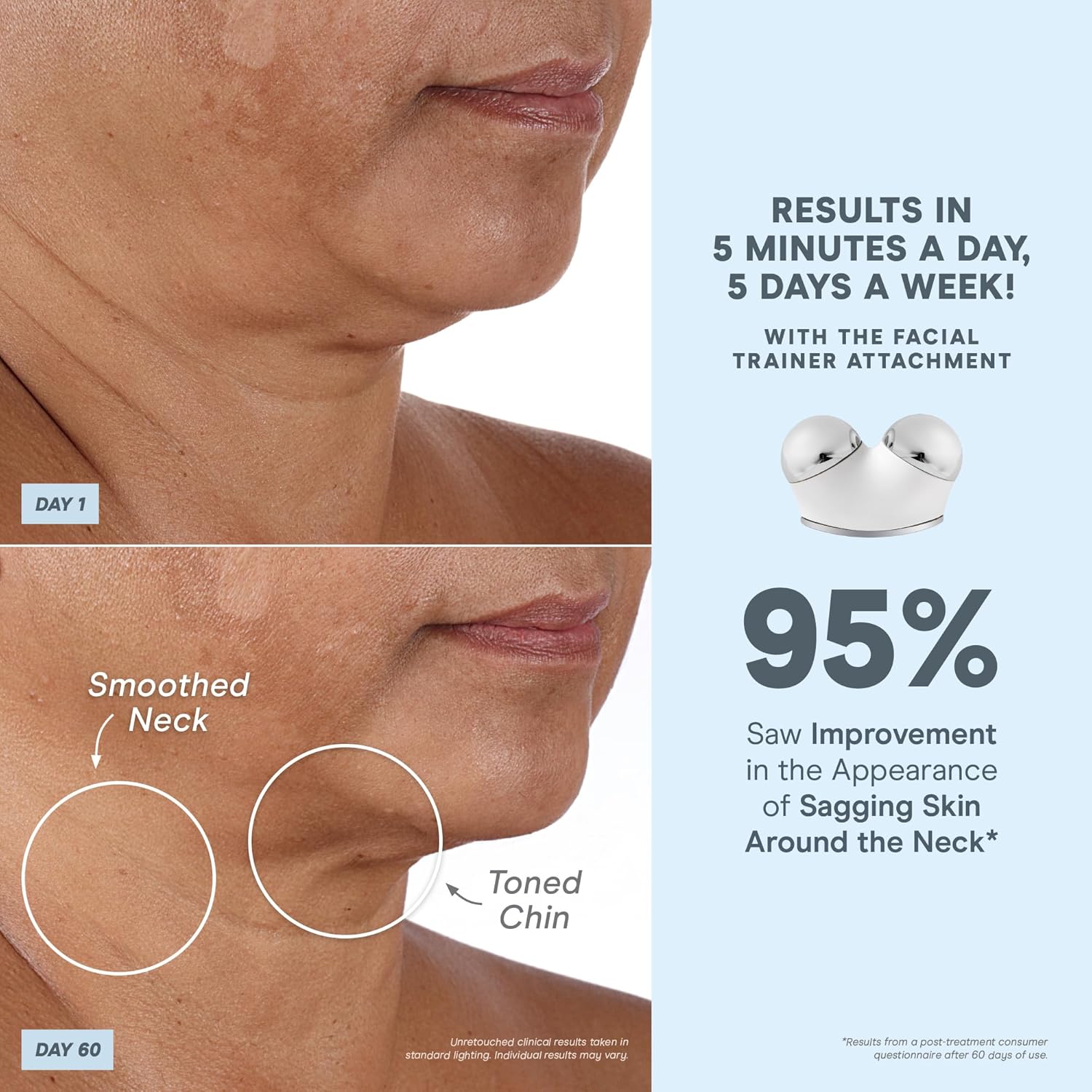NuFACE Trinity+ Microcurrent Facial Device Kit - FDA Cleared Face Sculpting & Neck Tightening Device to Contour Cheeks & Brows + Microcurrent Gel Activator & Silk Creme - Image 3