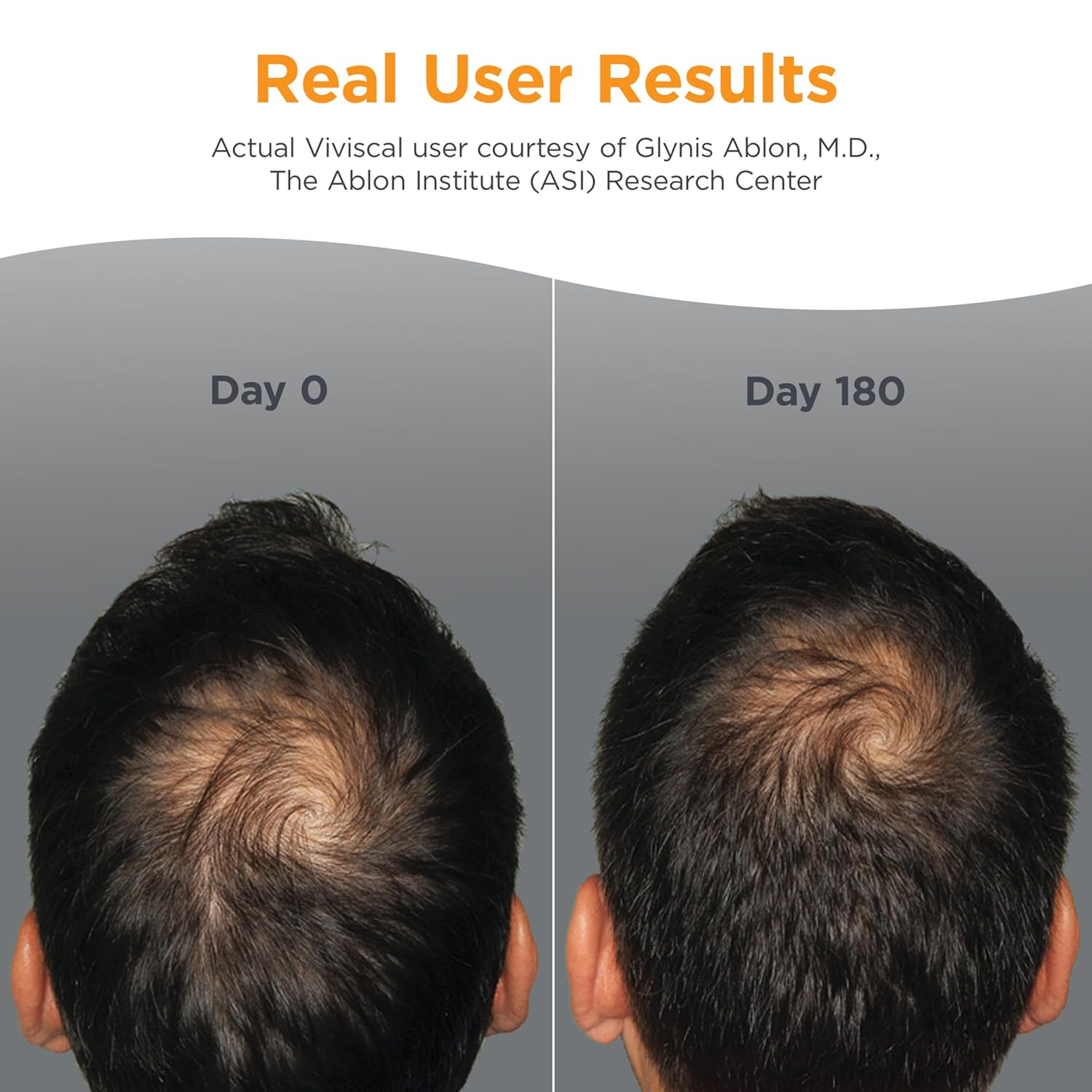 Viviscal Men’s Hair Growth Supplements for Men | 180 Tablets - Image 5